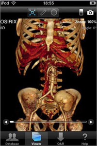 4. Osirix