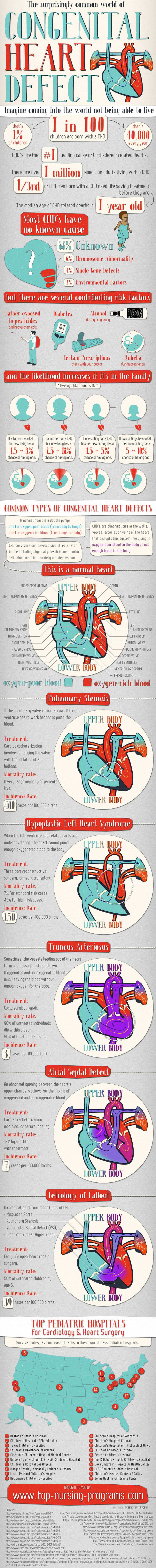 congenital-heart-defect